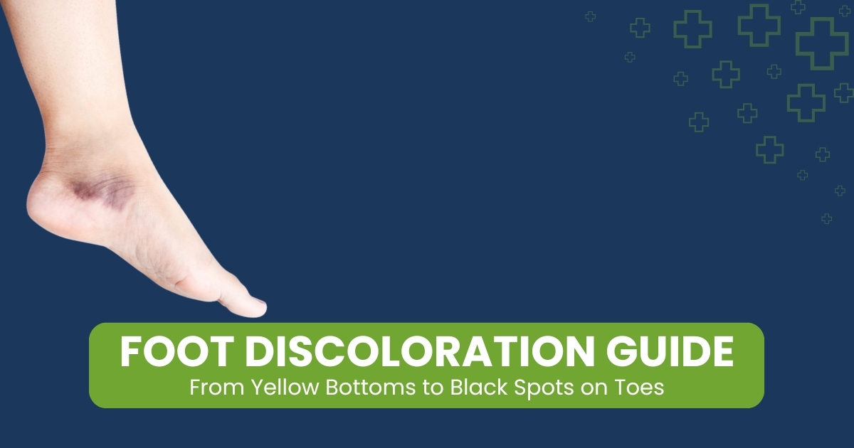 Foot Discoloration Guide: Yellow Bottoms to Black Spots on Toes