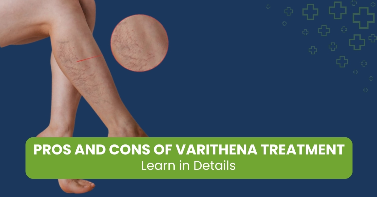 Pros and Cons of Varithena Treatment
