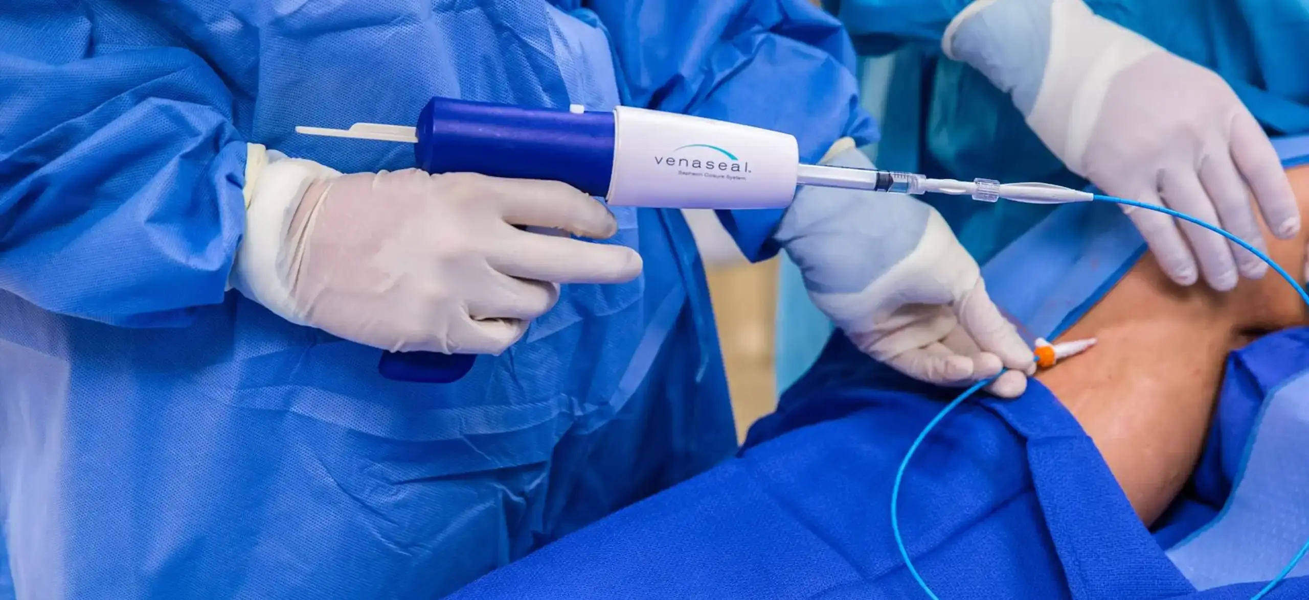 VenaSeal Minimally Invasive Varicose Vein Closure