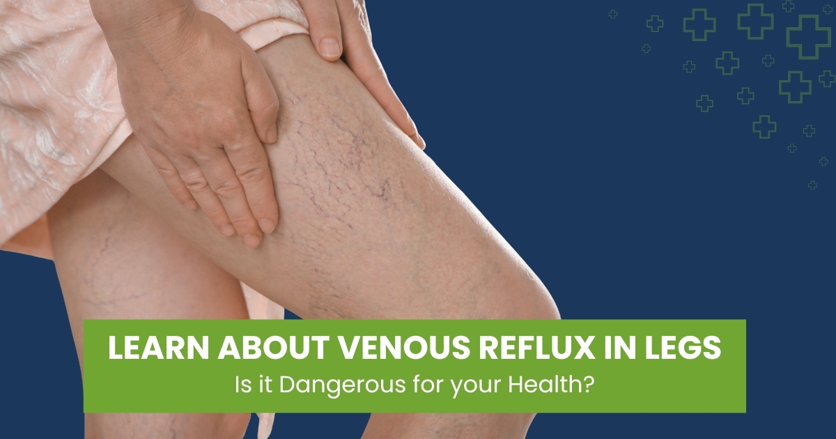 Venous Reflux in Legs: Causes, Symptoms & Treatments