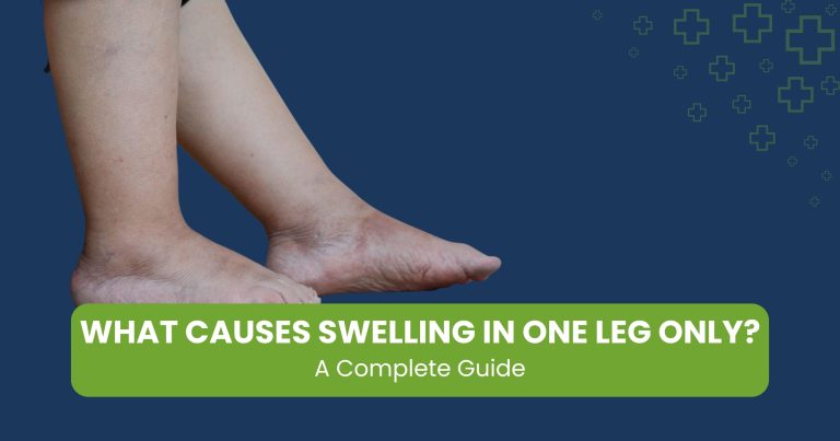 What Causes Swelling in One Leg Only? A Complete Guide