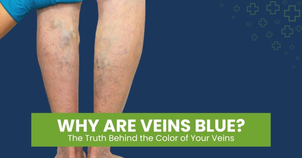 Why Veins Appear Blue — Science Explained