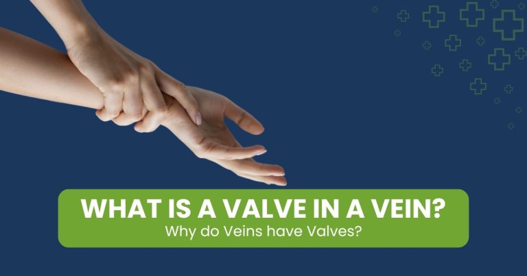 What is a Valve in a Vein? Why Do Veins Have Valves?
