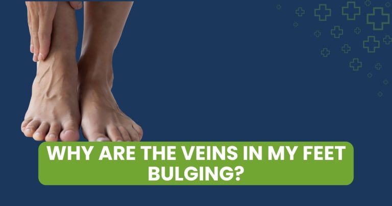 Why Are the Veins in My Feet Bulging?