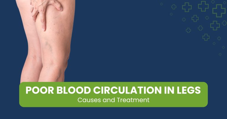 Poor Blood Circulation in Legs Causes and Treatment