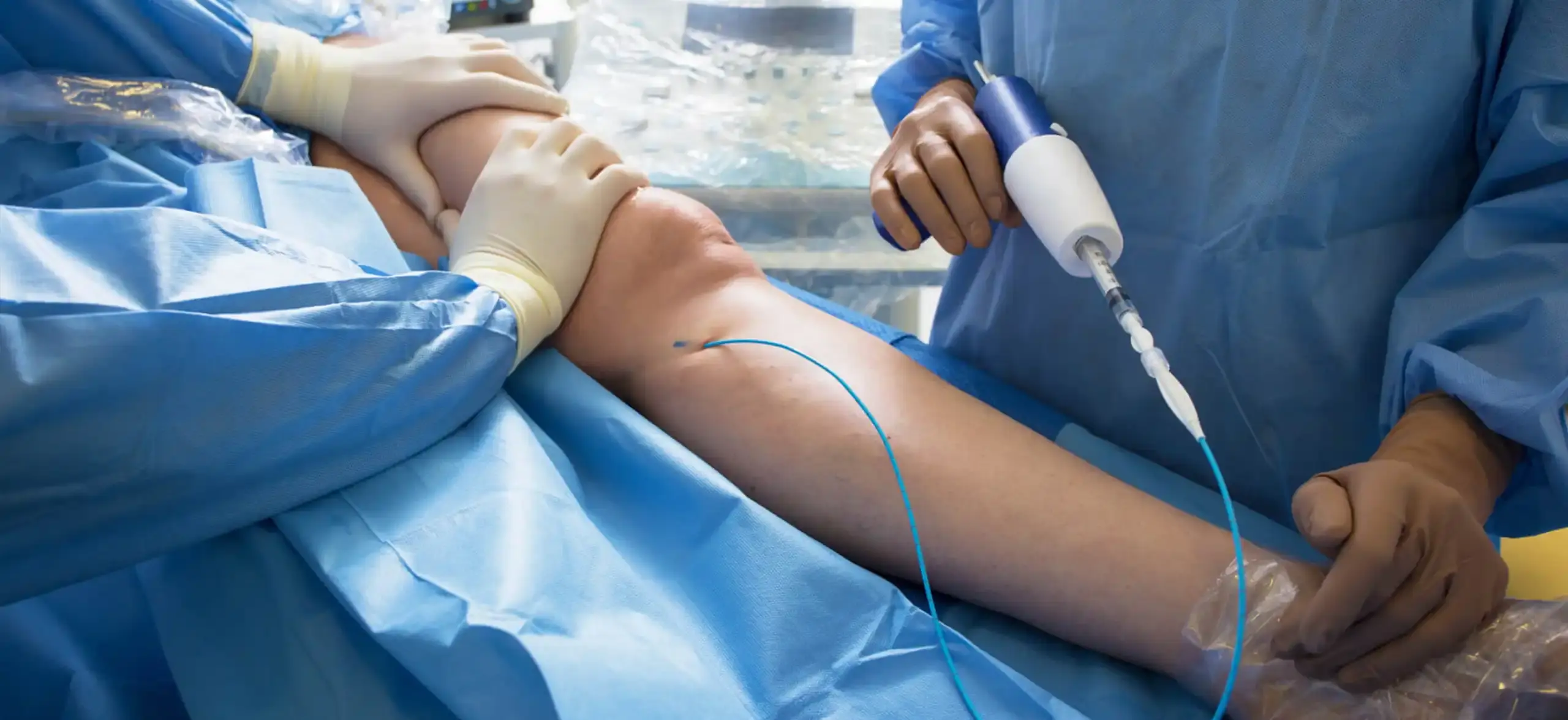 Venous Procedures for Varicose Vein Treatment