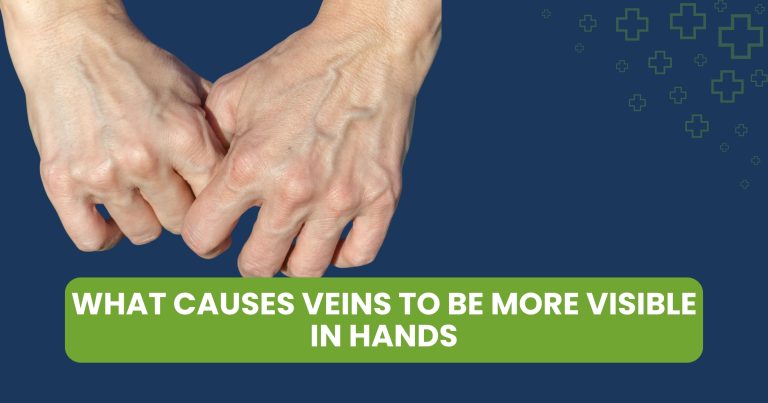 What Causes Veins to be More Visible in Hands