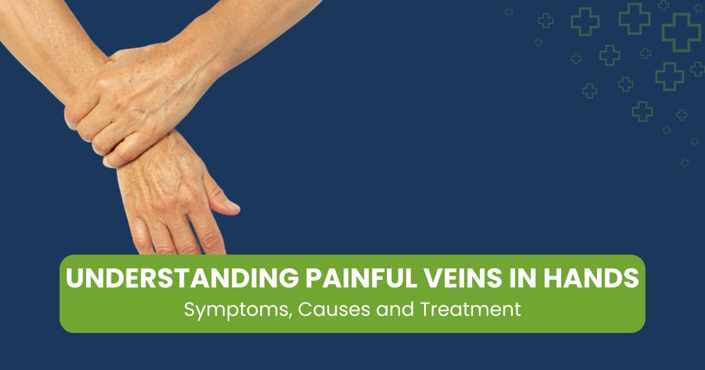 Painful Hand Veins — Causes and When to Seek Care